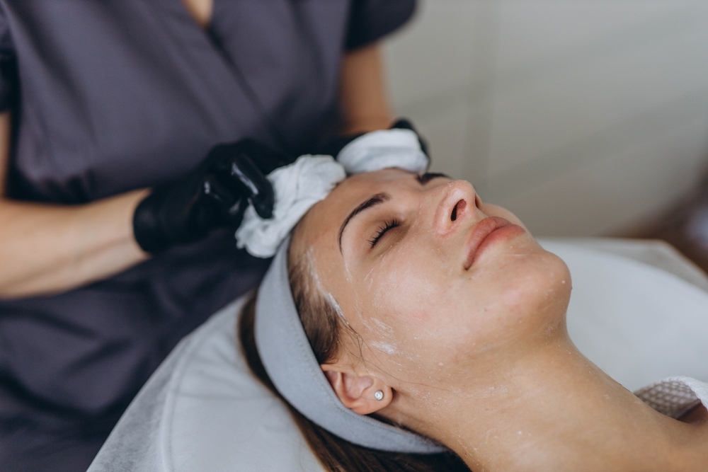 Chemical Peel